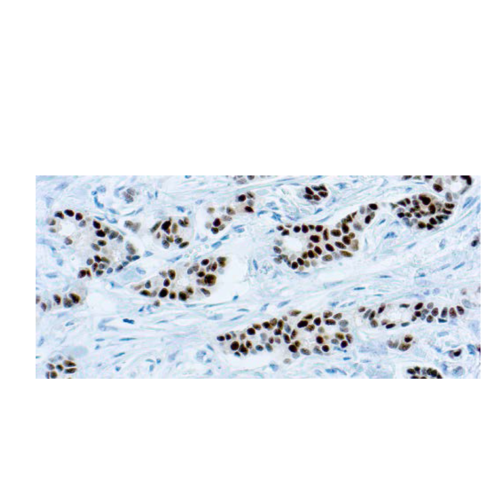 Estrogen Receptor (6F11)