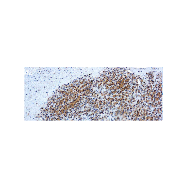 Glypican-3 (GPC3)