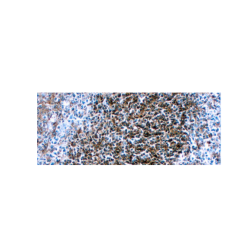 HLA-DR (β chain of DP, DQ & DR)