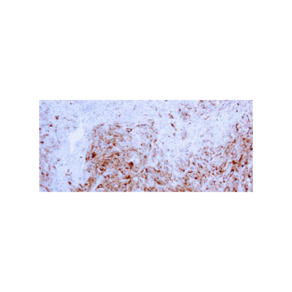 MART-1