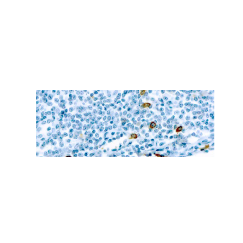 Mast Cell Chymase