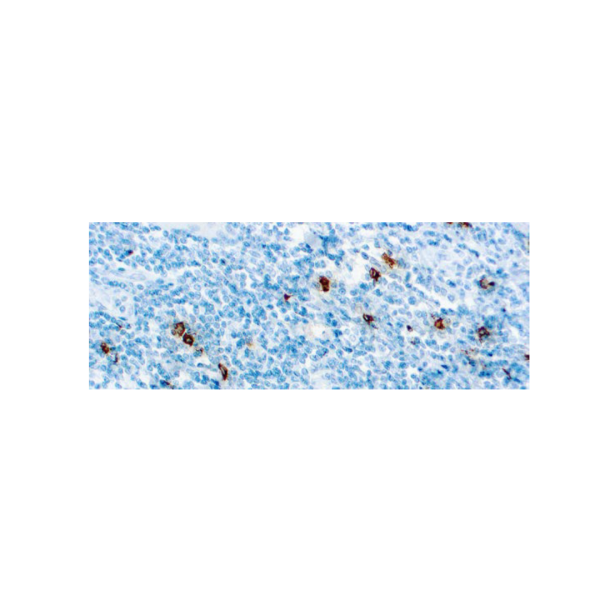 Mast Cell Tryptase