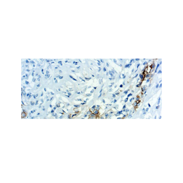 Mesothelin