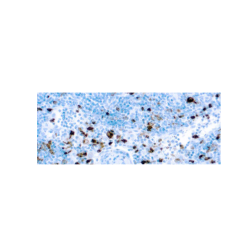 Mieloperoxidasa