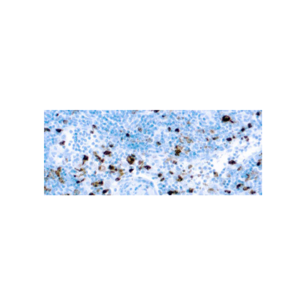 Mieloperoxidasa