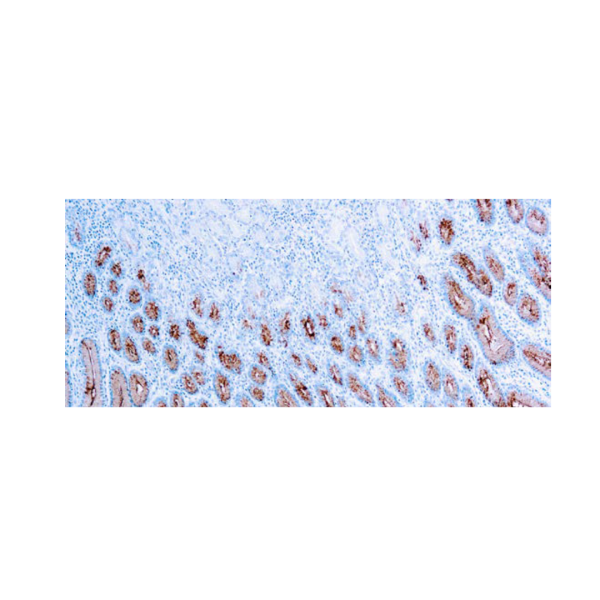 Mucin 5ACGastric Mucin