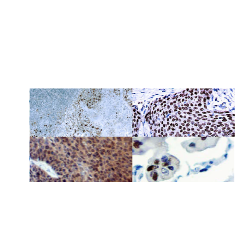 Panel cervical