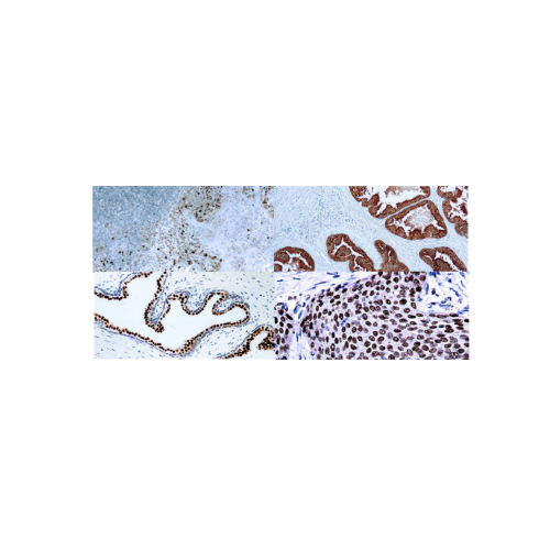 Prostata