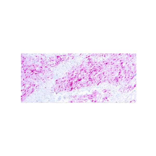 S-100 Protein S-100 Protein