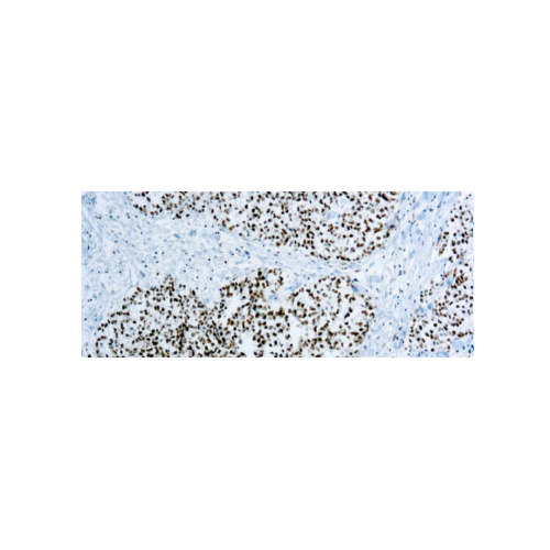 XRCC1
