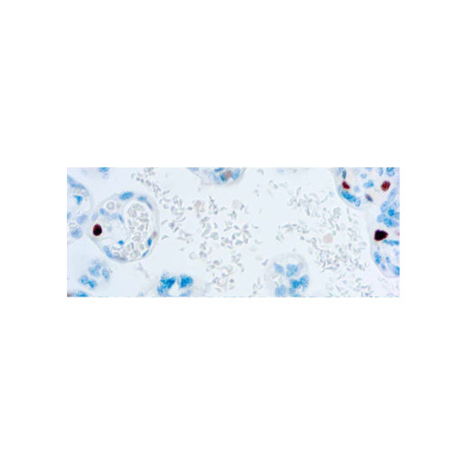 p57Kip2 (57P06)